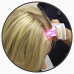  circ - Belgravia Centre Hair Loss Clinic Laser Therapy "width =" 150 "height =" 150 "/> Le Belgravia Center ------------------- --------------- </h2>
<p> <strong> Le Belgravia Center </strong> est le leader du traitement de la perte de cheveux au Royaume-Uni, avec deux cliniques basées au centre de Londres. Si vous vous inquiétez de la perte de cheveux, vous pouvez <strong> organiser une consultation gratuite </strong> avec un expert en perte de cheveux ou compléter notre Formulaire de consultation en ligne <strong> </strong> de n'importe où au Royaume-Uni ou dans le reste du monde. Consultez nos <strong> Histoires de réussite de perte de cheveux </strong>qui constituent la plus grande collection de ces réussites dans le monde et démontrent les niveaux de succès que tant de patients de Belgravia ont atteint. Vous pouvez également téléphoner <strong> 020 7730 6666 </strong> à tout moment pour notre ligne d'aide à la perte de cheveux ou pour organiser une consultation gratuite. </p>
<hr class=